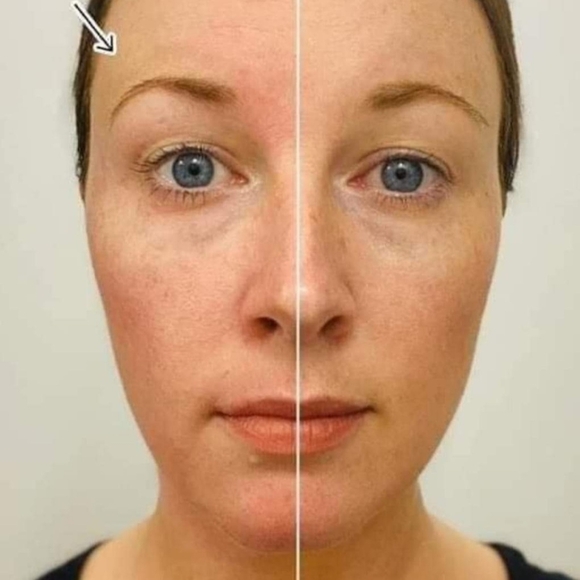 30 Min Lift Mask - Picture 4 of 4